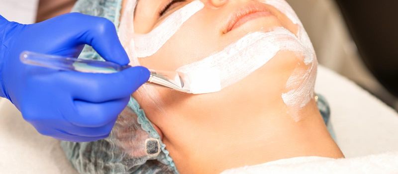 The beautician with brush applies a photochemical and glycolic peeling face mask to the female patient face in the beauty clinic