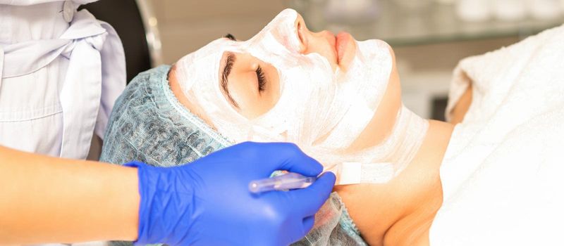 The beautician with brush applies a photochemical and glycolic peeling face mask to the female patient face in the beauty clinic