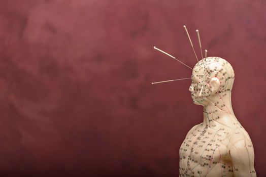 acupuncture model with needles in the head
