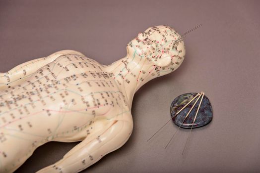 acupuncture model with needles in the head