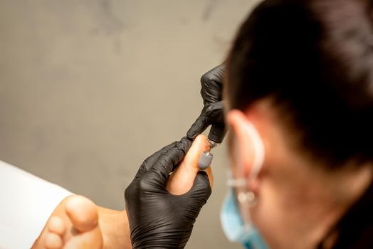 Podiatrist wearing black protective gloves cleaning the skin of foot from callus and corn with the professional electric tool