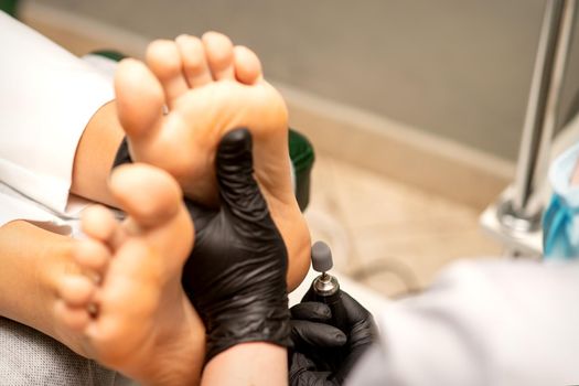 Podiatrist wearing black protective gloves cleaning the skin of foot from callus and corn with the professional electric tool