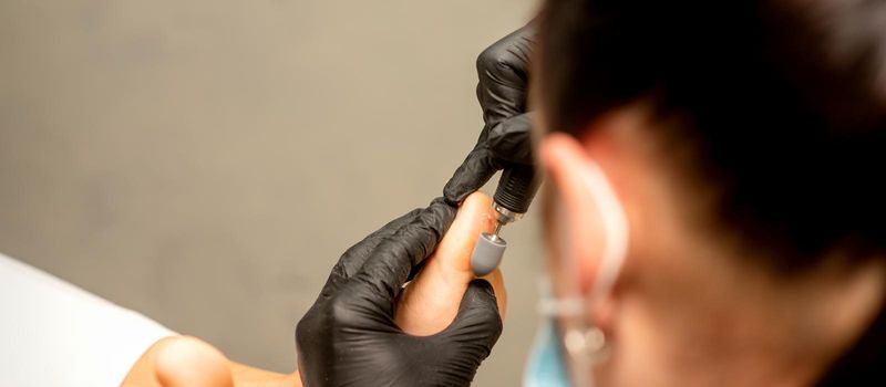 Podiatrist wearing black protective gloves cleaning the skin of foot from callus and corn with the professional electric tool