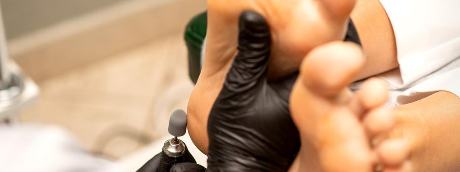 Podiatrist wearing black protective gloves cleaning the skin of foot from callus and corn with the professional electric tool