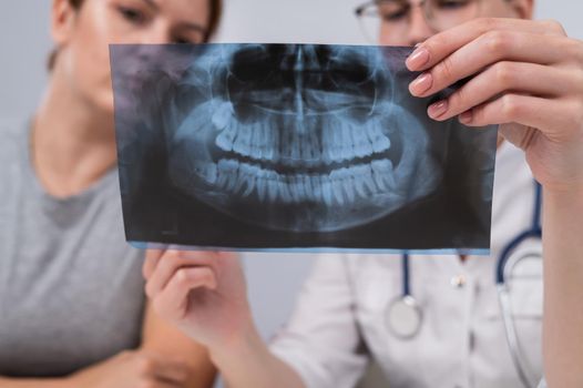 A woman doctor and a patient at the reception are discussing an x-ray of the jaw