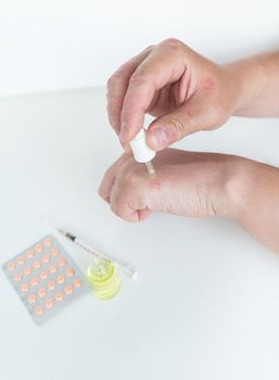 A man spreads healing gel on his hands. Causes of itchy skin can be dermatitis (eczema), dry skin, burns, food allergies. healthcare concept