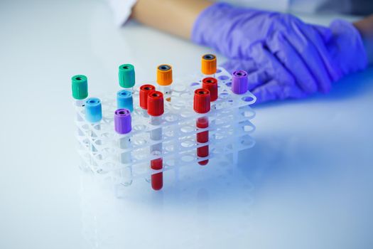 A medical professional, laboratory assistant, doctor performs an analysis in a laboratory, uses test tubes, a pipette and a petri dish for the presence of bacteria in the human body