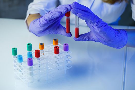A medical professional, laboratory assistant, doctor performs an analysis in a laboratory, uses test tubes, a pipette and a petri dish for the presence of bacteria in the human body