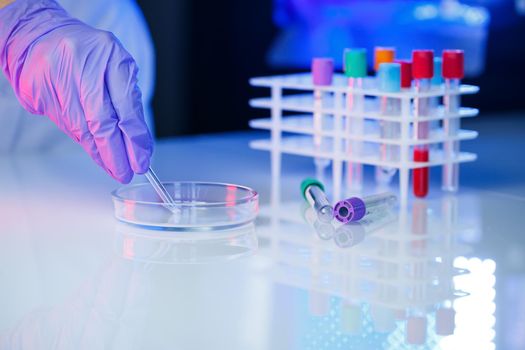 A medical professional, laboratory assistant, doctor performs an analysis in a laboratory, uses test tubes, a pipette and a petri dish for the presence of bacteria in the human body
