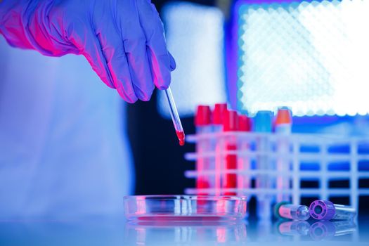 A medical professional, laboratory assistant, doctor performs an analysis in a laboratory, uses test tubes, a pipette and a petri dish for the presence of bacteria in the human body