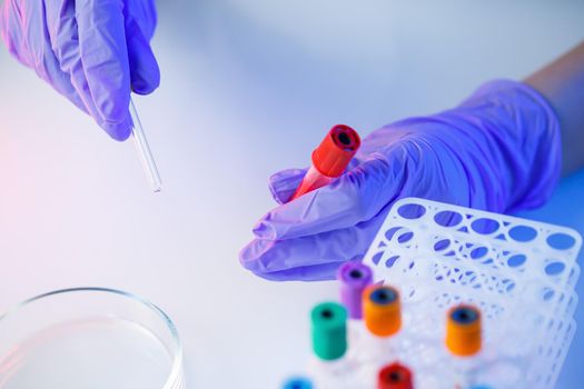 A medical professional, laboratory assistant, doctor performs an analysis in a laboratory, uses test tubes, a pipette and a petri dish for the presence of bacteria in the human body