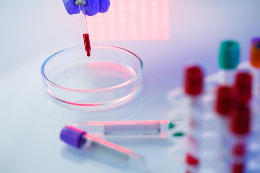 A medical professional, laboratory assistant, doctor performs an analysis in a laboratory, uses test tubes, a pipette and a petri dish for the presence of bacteria in the human body