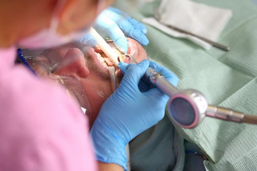 Patient with dentist checks teeth and drills tooth with caries. Dental treatment in dentistry concept