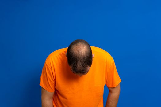 Man in an orange t-shirt leaning his head forward to reveal his bald spot, isolated on blue studio background