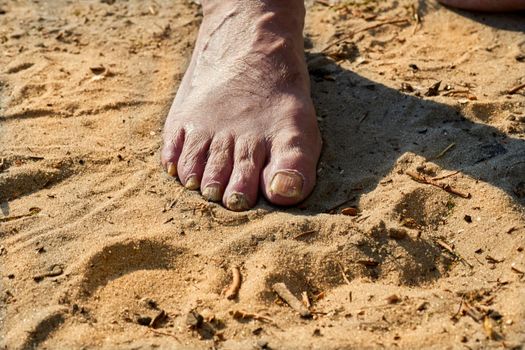 the lower extremity of the leg below the ankle, on which a person stands or walks. Foot of an elderly man with painful brittle nails on the summer sand. High quality photo