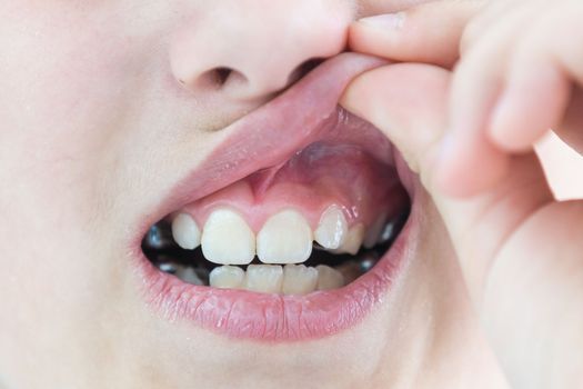 Portrait of little cute girl shows her orthodontic appliance on a white background.