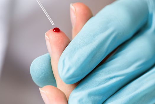 Doctor piercing patients finger with lancet in clinic closeup. Taking blood for close-up analysis, a clinical blood test. Finger prick