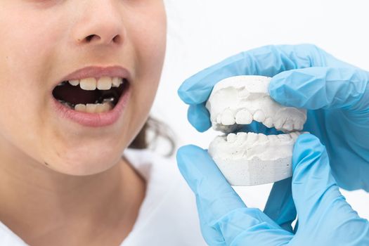 little girl with plaster cast of teeth and with the metal apparatus on the teeth