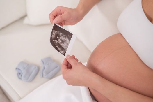A faceless pregnant woman sits on a white sofa and holds an ultrasound photo of the fetus