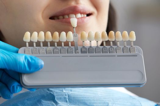 Dentist choosing color of tooth enamel for patient. Dentist applying sample from tooth enamel scale to caucasian female patient teeth