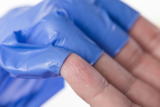 The doctor takes off his blue rubber gloves, the skin on his hands is wrinkled from moisture. Wrinkled fingers after wearing rubber gloves for a long time