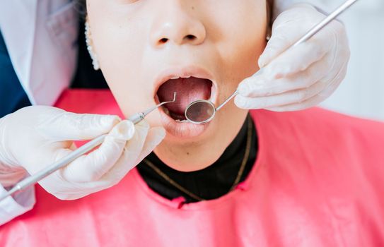 Dentist checking patient mouth with dental mirror. Close-up of patient checked by dentist, close-up of dentist's hands checking patient's mouth, dentist performing stomatology