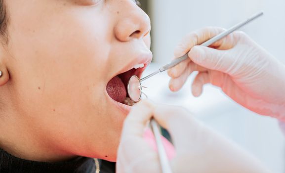 Close up of patient checked by dentist, Dentist checking patient's mouth, close up of dentist's hands checking patient's mouth, Dentist performing stomatology