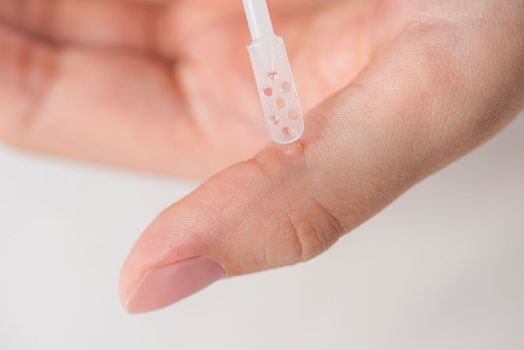 Wart treatment process. The doctor applies the medicine with a special spatula to the wart. Getting rid of a benign formation on human skin by using a medicine