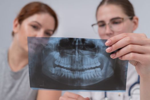 A woman doctor and a patient at the reception are discussing an x-ray of the jaw