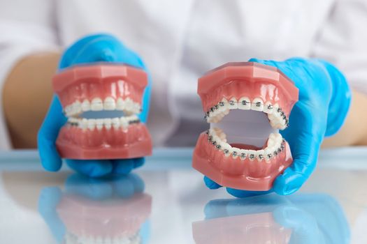 Doctor orthodontist showing model of human jaw with wire braces and aligners explaining difference