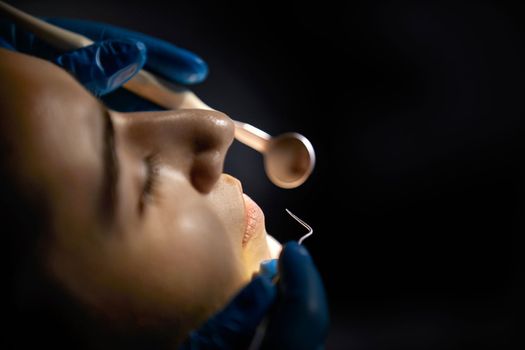 Dentist checking teeth of a patient with dental mirror. Woman having teeth examined at dentists