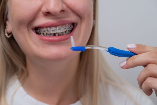 Caucasian woman cleaning her teeth with braces using a brush. Cropped portrait
