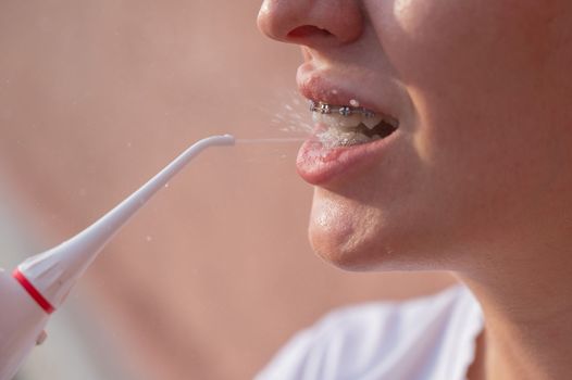 A woman with braces on her teeth uses an irrigator. Close-up portrait