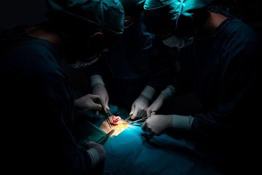 Surgical team performing surgery to patient in sterile operating room. In a surgery room lit by a lamp, a professional and confident surgical team provides medical care to an unconscious patient.