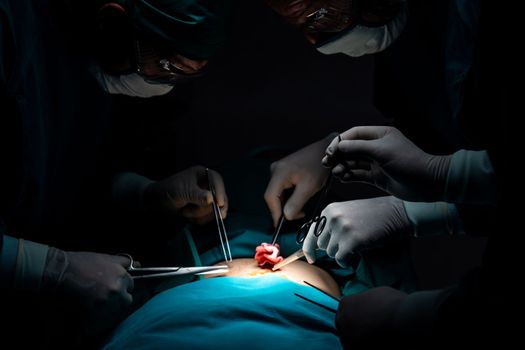 Surgical team performing surgery to patient in sterile operating room. In a surgery room lit by a lamp, a professional and confident surgical team provides medical care to an unconscious patient.