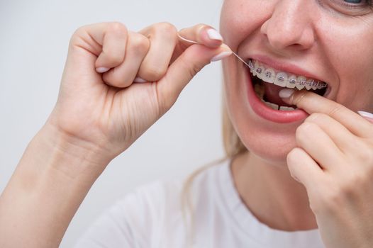 Caucasian woman cleaning her teeth with braces using dental floss