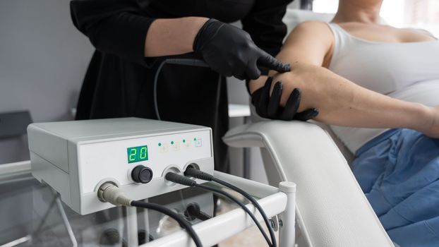Dermatologist removes a mole on a patient's arm using an electrocoagulator