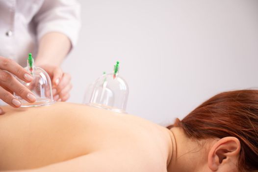 Female massage therapist uses vacuum cans on the patient's back