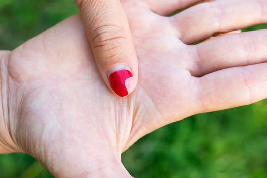 The girl shows a bad old manicure. Overgrown nail polish, broken nail. Manicure correction, old manicure. Nail care, it's time to go to the salon