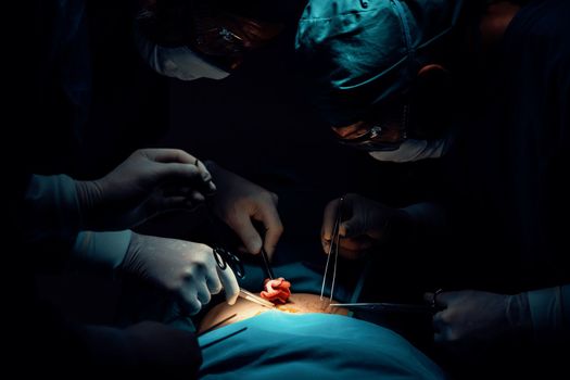 Surgical team performing surgery to patient in sterile operating room. In a surgery room lit by a lamp, a professional and confident surgical team provides medical care to an unconscious patient.