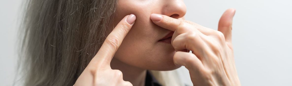 young woman squeezing pimples on the face.