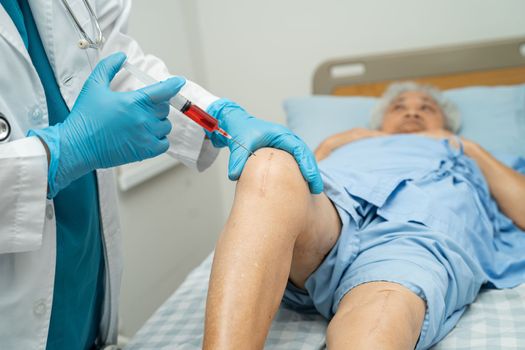 Asian doctor inject Hyaluronic acid platelet rich plasma into the knee of senior woman to walk without pain.