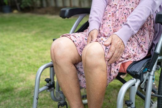 Asian senior or elderly old lady woman patient show her scars surgical total knee joint replacement Suture wound surgery arthroplasty on bed in nursing hospital ward, healthy strong medical concept.