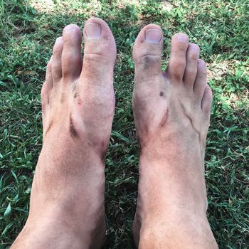 Man with dirty feet sitting in the park . High quality photo