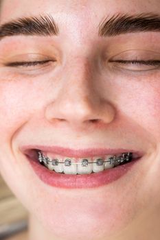 Close-up of a young woman smiling with braces on her teeth