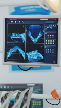 Close up of medical stomatology display with teeth x ray images on it. Empty professional hospital orthodontist chair with nobody in it. Close up revealing shot. Modern dentistry equipment