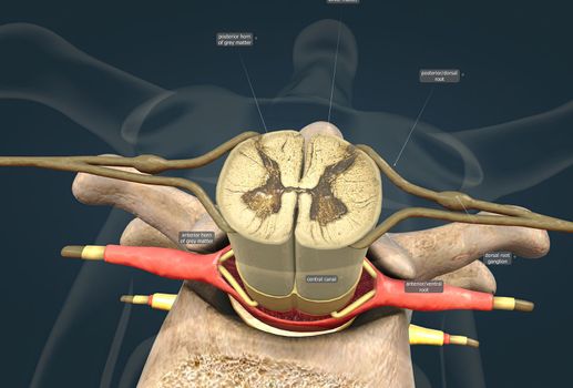 A slipped disc may also be called a prolapsed or herniated disc.