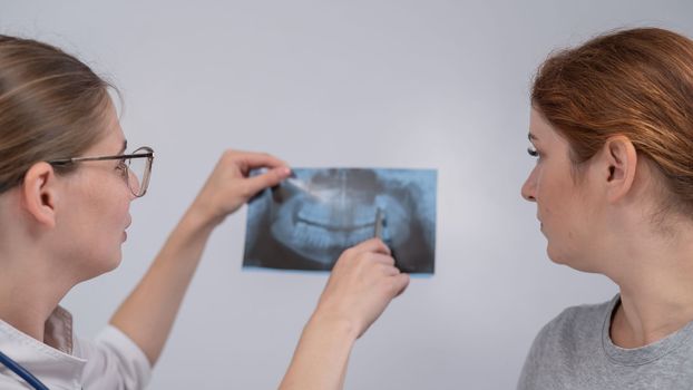 A woman doctor and a patient at the reception are discussing an x-ray of the jaw