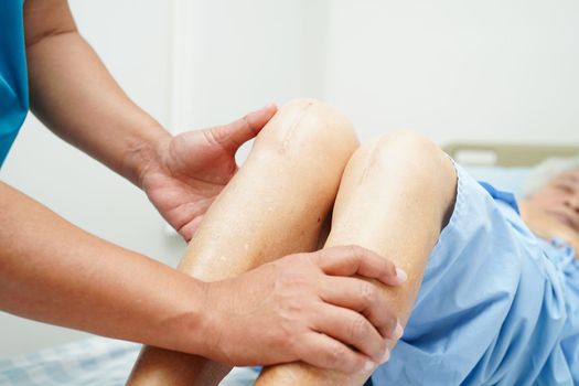Doctor checking Asian elderly woman patient with scar knee replacement surgery in hospital.