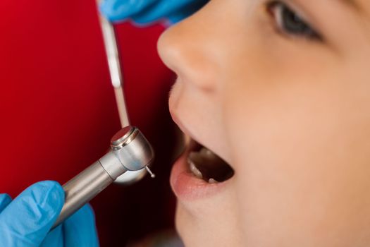 Dental drill close-up. Child dentist drilling teeth of kid girl in dentistry clinic. Teeth treatment. Dental filling for child patient